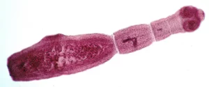 Fuchsbandwurm - Echinococcus multilocularis